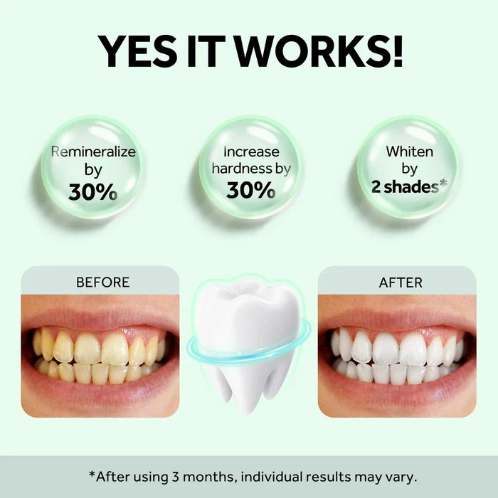 MySmile Nano-Hydroxyapatite Toothpaste for Sensitive Teeth