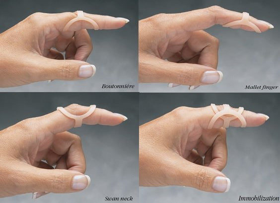 Oval-8 Finger Splint